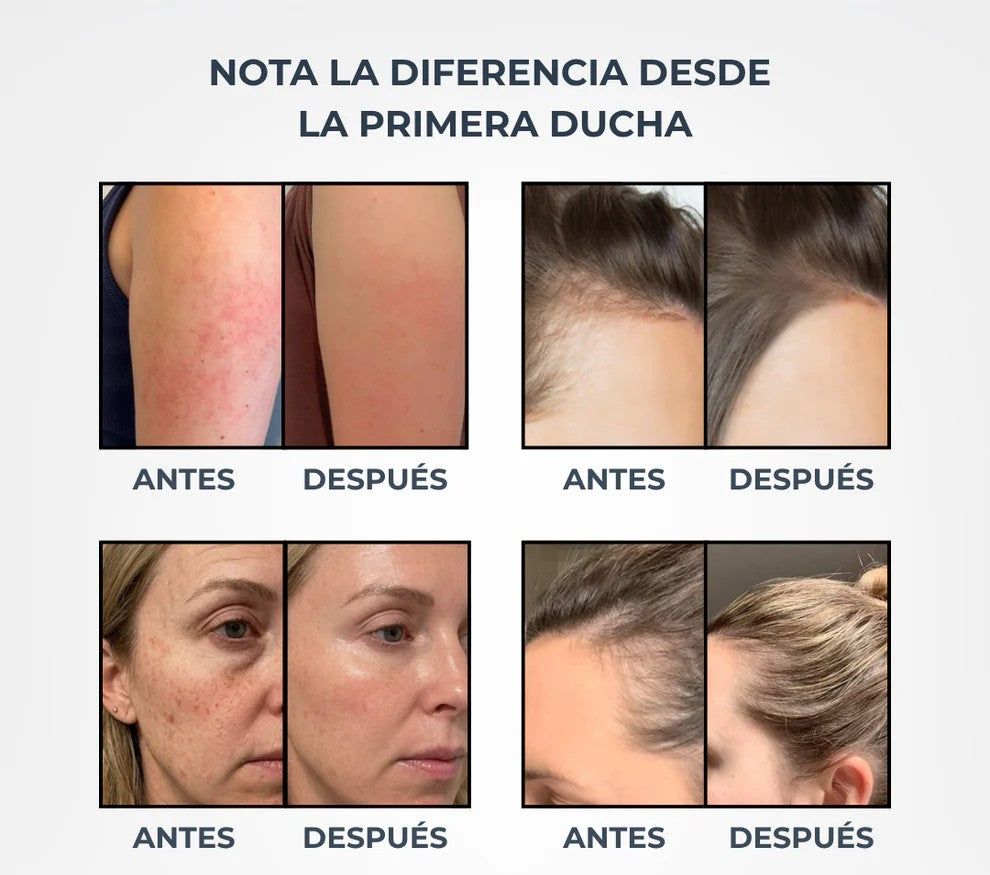 Cabezal Multifuncional de Alta Presión